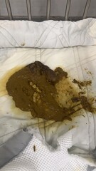 Human Feces on Hospital Bed Linen.