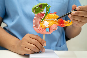 Pancreatitis, pancreatic cancer, Asian doctor with pancreas, gallbladder and bile duct human...