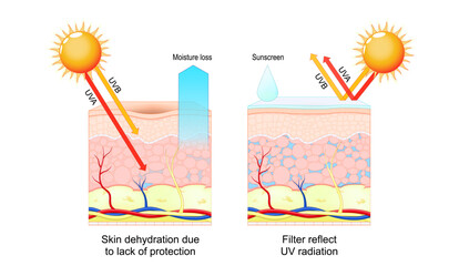Skin protection. Sunscreen, UV radiation and SPF