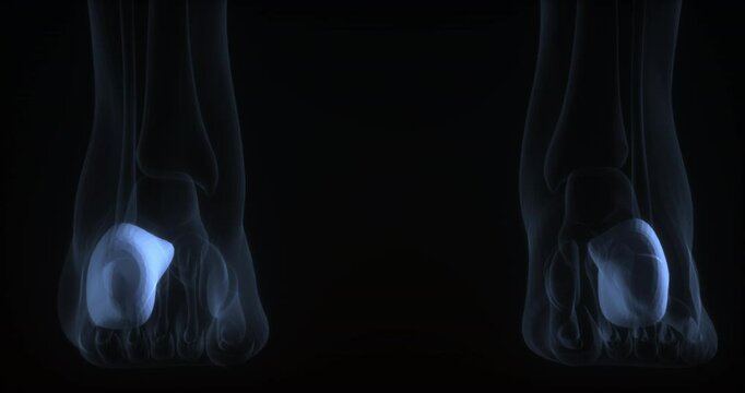 Calcaneus bones in human body. X Ray. Loop