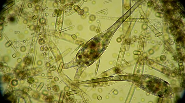 Microscopic Phytoplankton: Diversity of Aquatic Microorganisms