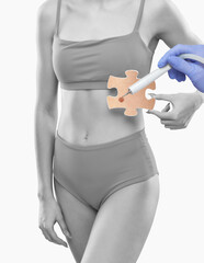 A beautician removes a large ugly mole from a woman’s belly.