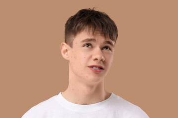 Thoughtful teenage boy with acne on beige background, closeup