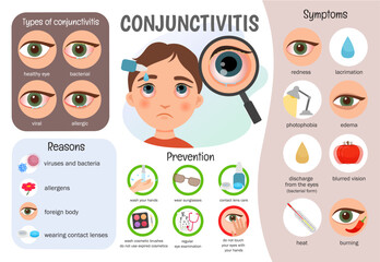 Vector infographics conjunctivitis. Medical poster types of disease, symptoms, prevention.
