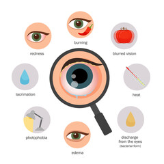 Vector medical poster symptoms of conjunctivitis.
