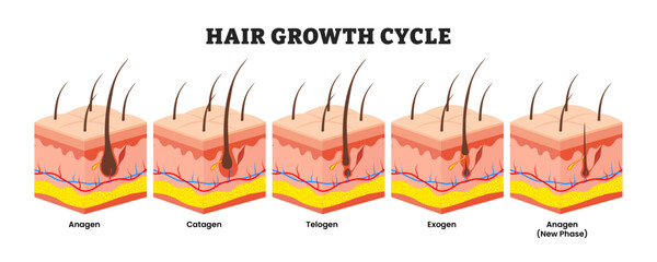 Steps of hair growth cycle steps process progress, medical poster design healthcare, anagen, catagen, telogen, exogen, anagen (new phase). Follicular phase, Human hair follicle anatomy. Skin Layers