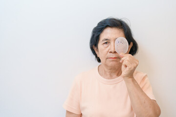 Elderly Woman with eye protective shield after eye surgery. Eye disease, Cataract,  Glaucoma, Age...