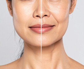 Obraz premium Collage, before after and face of woman for skincare, anti aging and beauty with surgery in studio. Female model, transformation and makeover with treatment. Generated Image