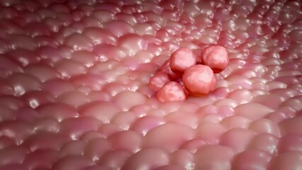 Cancer cell growth uncontrollably over tissue, Tumor infection cells and spreading, 3d animation.