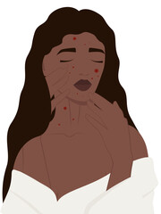 Afro woman with acne, problem skin concept. Cartoon scene skin problem isolated on white background