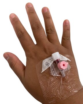 Hand with a pink IV cannula.