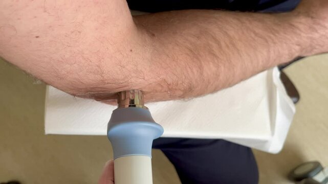Male patient receiving radial shockwave therapy for tennis elbow pain relief