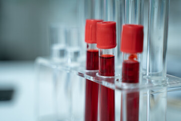 Laboratory research with blood sample in tube being dripped for medical test using liquid medicine...