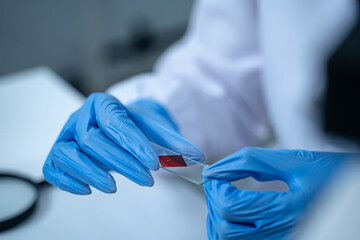 In the laboratory, blood is carefully dripped into test tubes for medical and biology research,...
