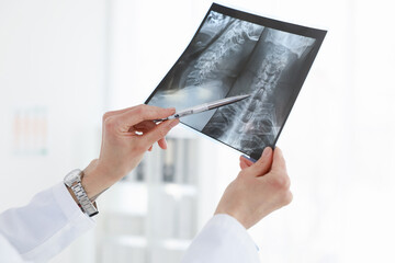 Doctor examining MRI scan in hospital, closeup
