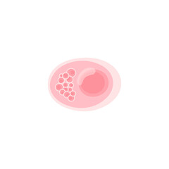Chlamydia Vektor Illustration 