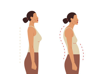 A young woman with straight and healthy posture and with poor posture. Flat style vector illustration. Straight and curved back, side view.