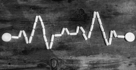 Electrocardiograma