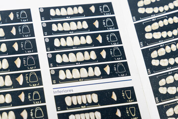 Organized dental shade guides with alphanumeric labels displaying various tooth colors for precise restorations and treatment planning