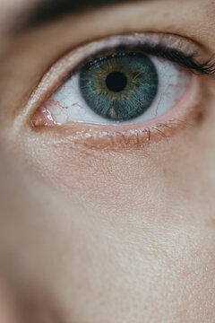 Close Up woman's eye with heterochromia & red capillaries in the eye