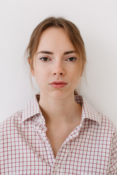 Young woman with Vitiligo shows neutral expression
