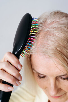 Age-related problem of hair loss.