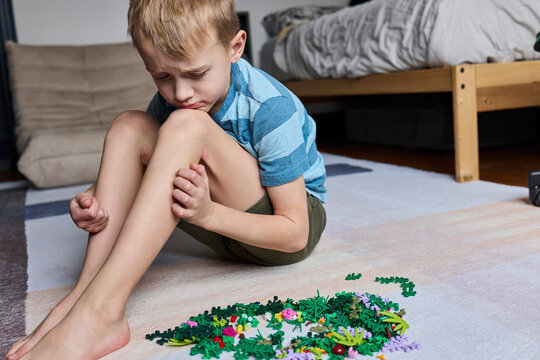 Little boy with eczemaA l sits on a rug upset