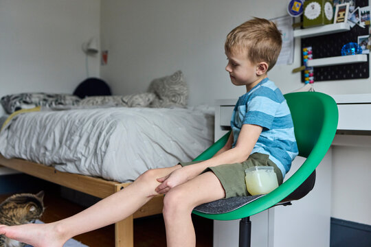 Child's arms with eczema
