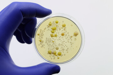 Microbiology. Petri dish with colonies of bacteria. Pathogens, infection.