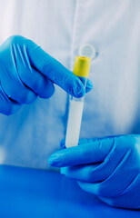 laboratory worker holding a test tube with semen