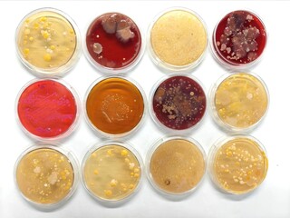 Germs and infections. Microbiological culture plates with colonies of bacteria on a laboratory bench.