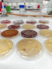 Germs and infections. Microbiological culture plates with colonies of bacteria on a laboratory bench.