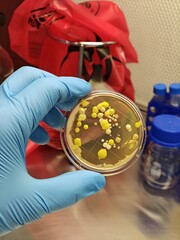 Germs and infections. Doctor's or scientist's glove with a Petri dish with colonies of bacteria. 