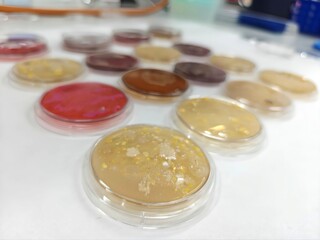 Germs and infections. Microbiological culture plates with colonies of bacteria on a laboratory bench.