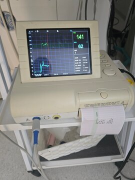 A fetal monitor display shows real-time heart rate and uterine contractions, with numerical readings on the right side.