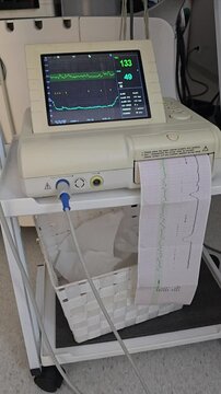 Fetal monitor CTG machine displaying baby heart rate and printing chart during labor 4K