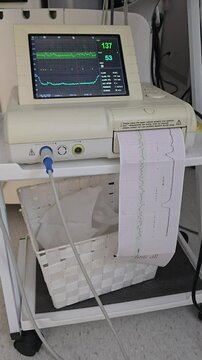 Fetal monitor CTG machine displaying baby heart rate and printing chart during labor 4K
