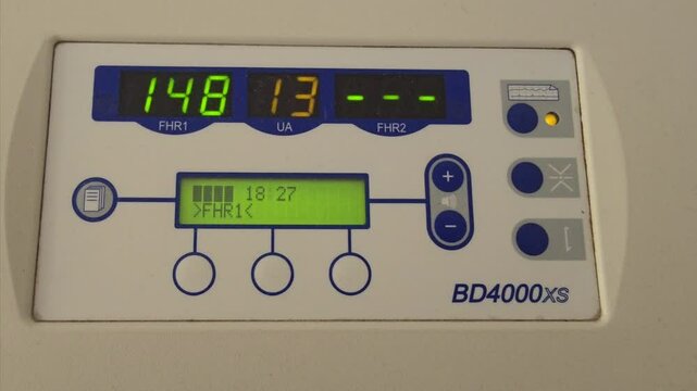 This video captures the digital display of a fetal monitor. The screen shows readings Buttons for adjustment and power are visible on the right.