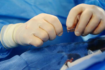 Operations to remove blood clots. Prevention of blood clots. Endovascular surgery. Surgical interventions on blood vessels.