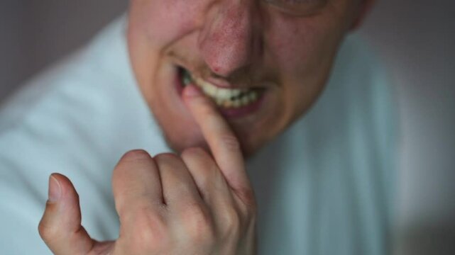 A man is worried and bites his nails.
Nervous state and fingers in the mouth.
Nail biting close-up.
Hand and nail hygiene.