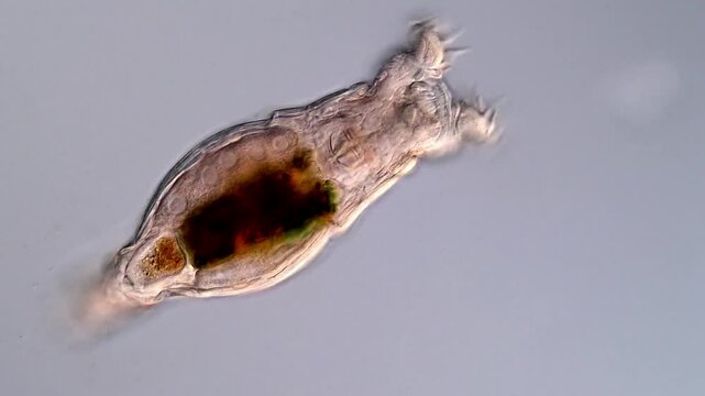 Movement of freshwater Rotifer under microscope