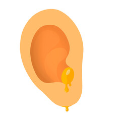 Otitis Media Infection