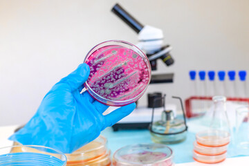 Examine bacteria in petri dishes in the laboratory. Selective focus.