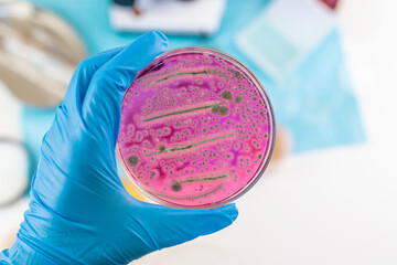 Examine bacteria in petri dishes in the laboratory. Selective focus.