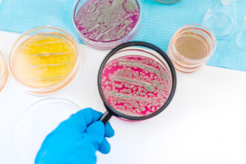 Examine bacteria in petri dishes in the laboratory. Selective focus.
