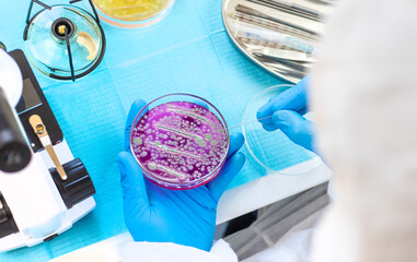 Examine bacteria in petri dishes in the laboratory. Selective focus.