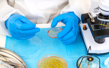 Examine bacteria in petri dishes in the laboratory. Selective focus.
