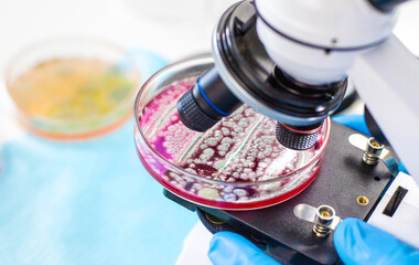 Examine bacteria in petri dishes in the laboratory. Selective focus.