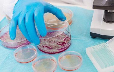 Examine bacteria in petri dishes in the laboratory. Selective focus.
