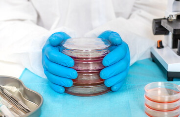 Examine bacteria in petri dishes in the laboratory. Selective focus.